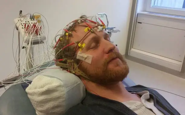 Vagus Nerve